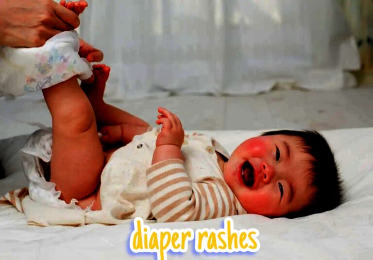 Diaper Rashes and solutions