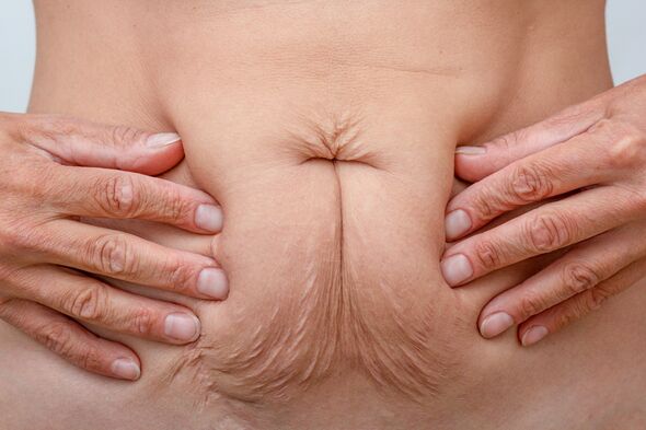 Body Weight changes After pregnancy