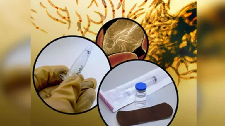 Malaria during pregnancy
