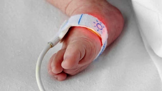 Oxygen Saturation and Its Measurement in Babies
