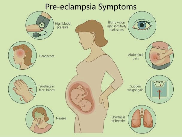 Preeclampsia during Pregnancy