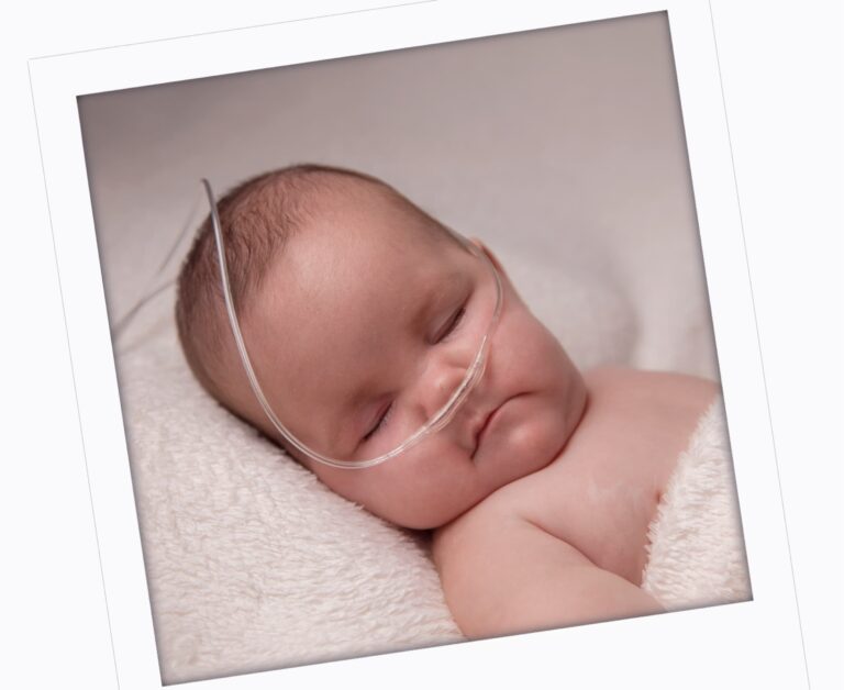 Prader-Willi Syndrome