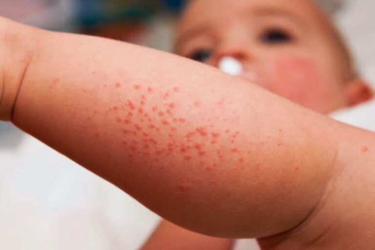 Skin issues in babies