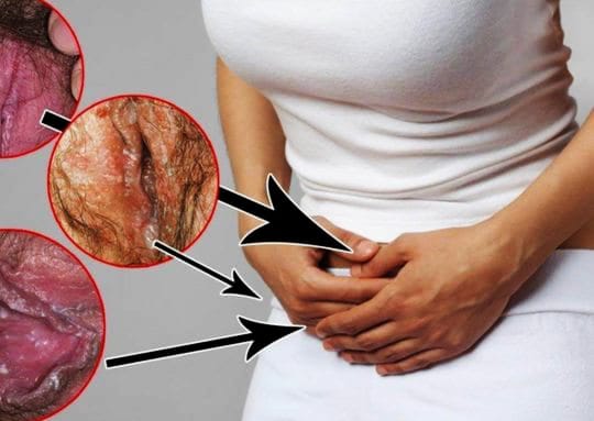 Vaginal Infection during Pregnancy